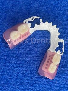 Quality Adjustable Flexible Dental Prosthesis Stable Comfortable Immediate Partial Denture wholesale