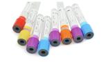 7ml 8ml Gel Vacutainer Blood Collection Accessories Yellow Top Acd Tube