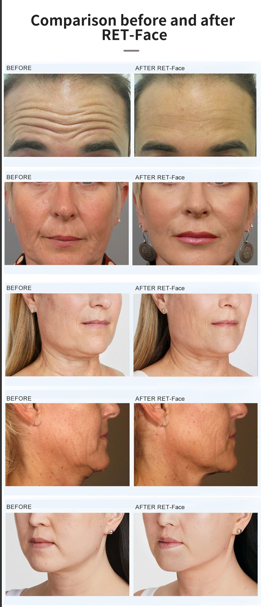 Vertical Magnetic Facial Ems rf Skin Rejuvenation Lifting Skin Tightening slimming Rf Lifting Machine machifor sal