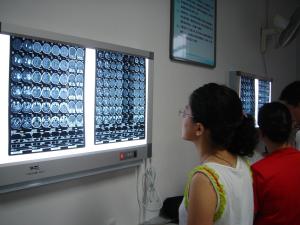 Quality 10in X 12in X Ray Dry Film wholesale