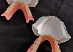 Comfortable CAD CAM Dental Implant Overdenture Easy Maintain