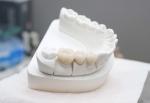 High Strength Dental Base Metal Alloys Wear Proof Dental Casting Alloys