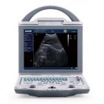 Diagnostic Medical Ultrasound Machine KX5600 Ultrasound Machine Full Digital B