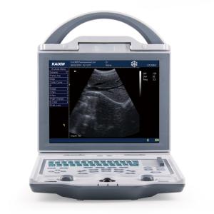 Quality Diagnostic Medical Ultrasound Machine KX5600 Ultrasound Machine Full Digital B Mode wholesale