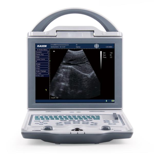 Diagnostic Medical Ultrasound Machine KX5600 Ultrasound Machine Full Digital B