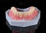 Discover the Power of Milled Full Denture Aesthetically Pleasing and Natural