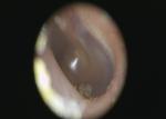 Clinical ENT Inspection Of Human Body Digital Video Otoscope With Color TFT LCD