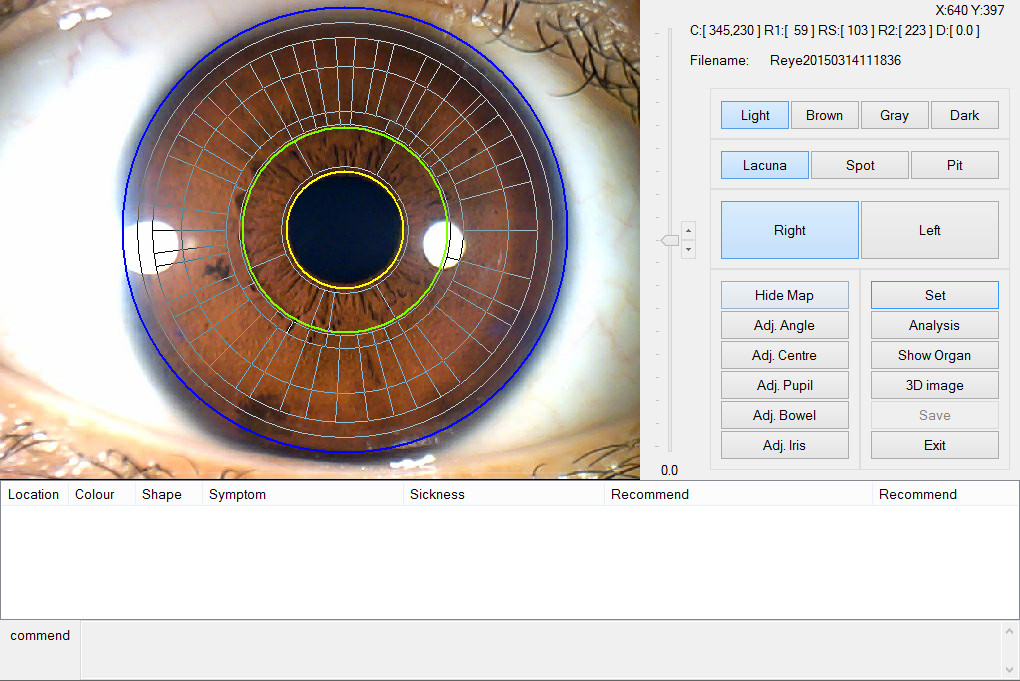 Handheld 12 MP Iriscope USB Iridology Camera For Professional Ophthalmology , CE