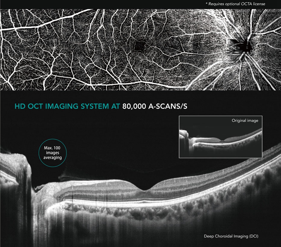 factory price hot selling Advanced OCT Ophthalmic OCT Optical Coherence Tomography