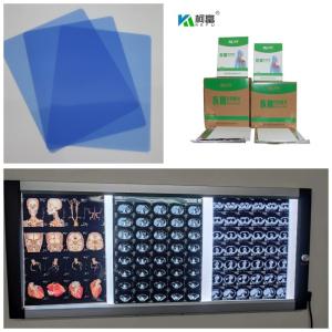 Quality 150 Microns Inkjet X Ray Film Printing Speed 1-3 Minutes For Medical 10inch wholesale