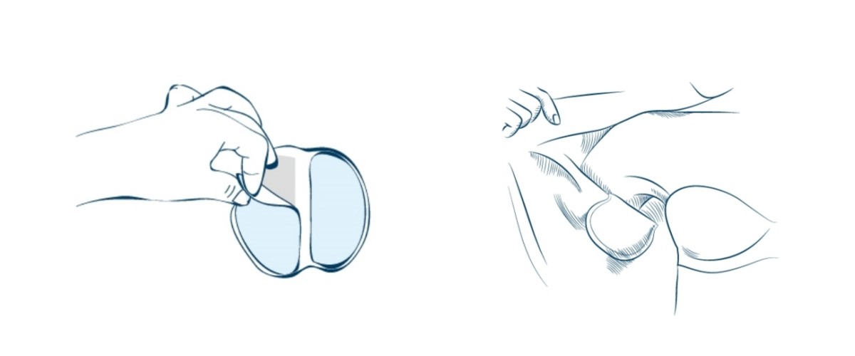 Non Washable Disposable Underarm Perspiration Pads Convenient Dryness
