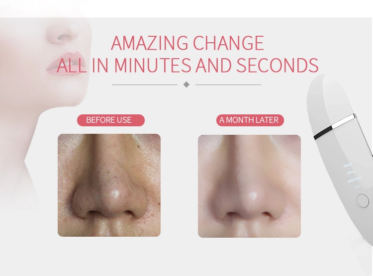 Ultrasonic Skin Scrubber Spatula Blackhead Remover Pore Cleaner Face Scraper
