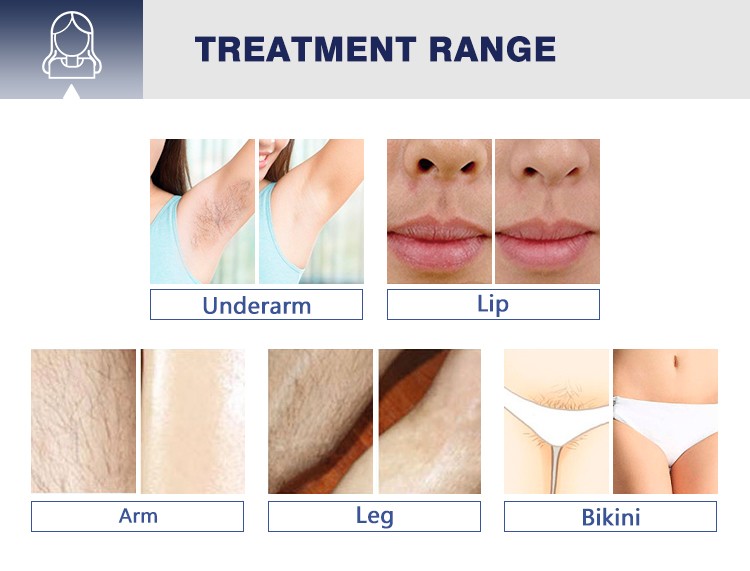 ice diode laser 755 808 1064 permanent hair removal machine price
