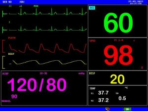 China Rechargeable Battery Portable Patient Monitor Compact and Lightweight on sale