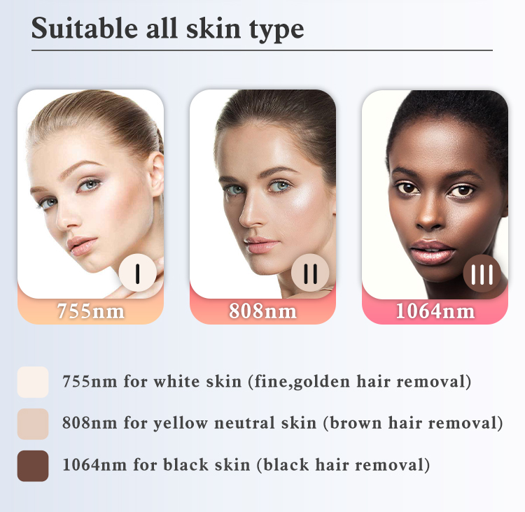 Triple Wavelengths Diode Laser Hair Removal Device 808nm 755nm 1064nm for Beauty Salon
