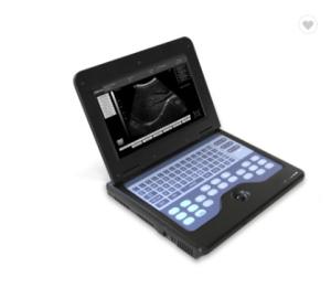 Quality CE 3.5MHz Doppler Ultrasound Equipment / Diagnostic Ultrasound Machine wholesale