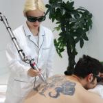 1064nm Q Switched Nd Yag Laser Picosecond Tattoo Removal Machine Stationary