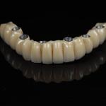 Cad Cam Implant PFM Crown Bridge Dental Medical Grade Adhesive