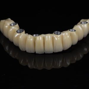 Quality Cad Cam Implant PFM Crown Bridge Dental Medical Grade Adhesive wholesale