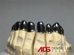 China Dental Lab Dental Implant Attachments Adjustable Telescopic