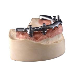 Quality All-On-4 Titanium CNC Implant Secured Dentures For Dental Clinic wholesale