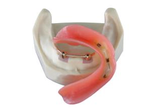 Quality High Biological Inter Miscibility Denture Dental Lab Safety Implant wholesale