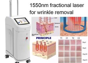 Quality 120mJ 1550nm Wrinkle Laser Machine CE Skin Tightening Laser Machine wholesale