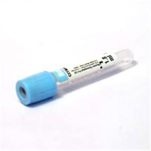 Quality Serum Light Blue Top Edta Blood Test Tube Serum Separator wholesale