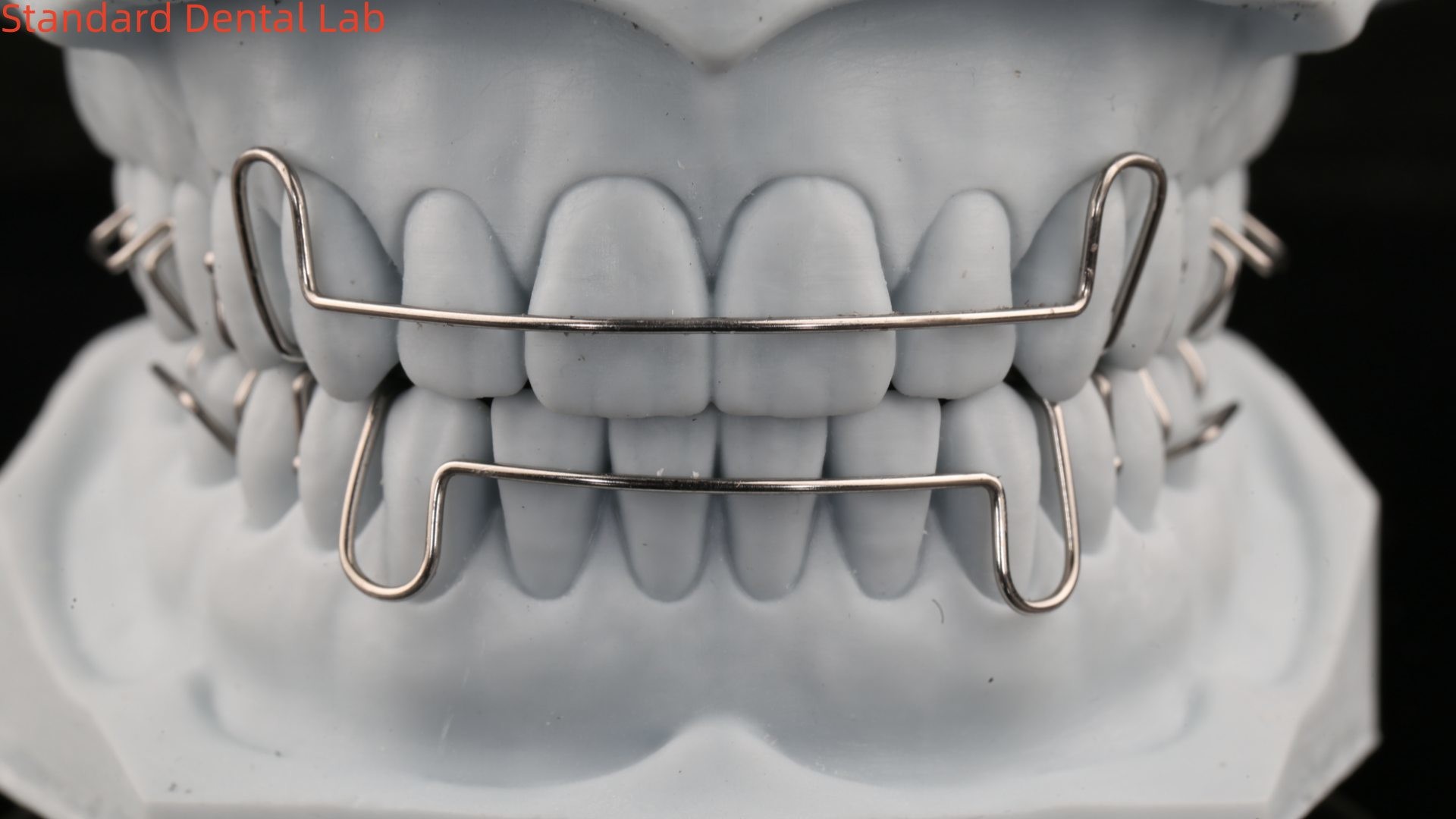 Teeth Expansion And Distalization Orthodontist Palate Expander China Dental Lab