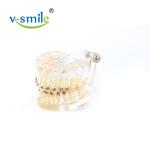 Oral Orthodontics Stainless Steel Self Ligating Brackets 0.022'' 0.018''