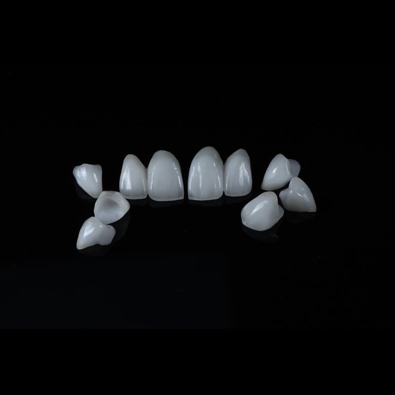 Dentures Aesthetic Emax All Ceramic Crowns Front Teeth OEM