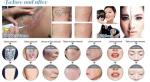 532nm 1064nm 1320nm Q Switch ND Yag Laser Machine For Skin Whitening / Dark
