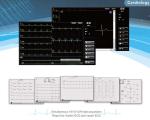 Ecg Machine 18 Channel Wifi Ecg Machine For Icu Hospital