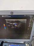 Original Linear Array Ultrasound Machine Probes ML6-15 For GE LogiqP6 Ultrasound