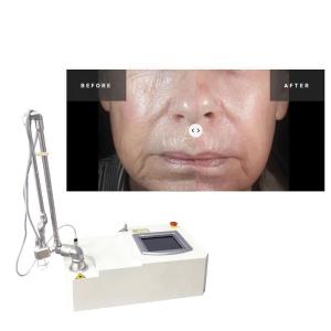 Quality Portable 15w Co2 Fractional Acne Surgical Scar Laser Machine wholesale