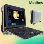 4D Realtime Musculoskeletal Ultrasound Systems fetal doppler ultrasound