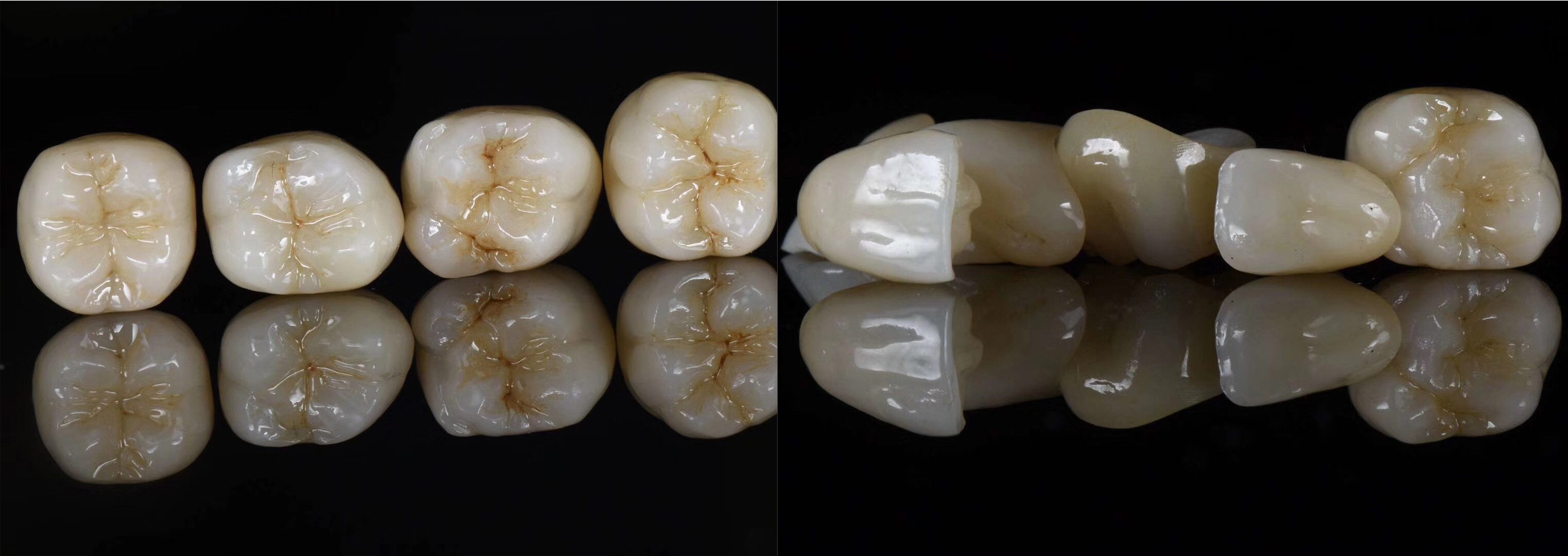 49% Translucent Zirconia Ceramic Block For Full Contour Crown