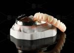 Translucent Full Contour Zirconia Bridge Over Milled Implant Bar Customized
