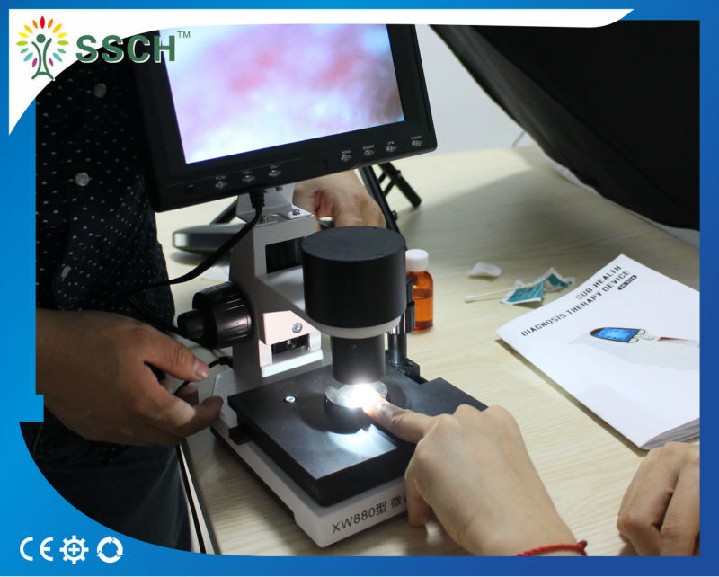7 Inch Black LCD Capillary Nail Microcirculation LED Cold Light