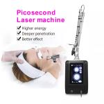 Laser tattoo removal q-switched nd:yag laser carbon peel/Q switched nd yag laser