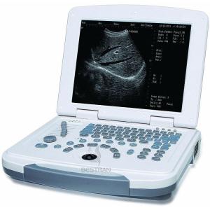 Quality Laptop Ultrasound Scanner wholesale