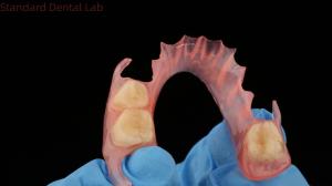 Quality 3D Print Model Dental TCS Valplast Flexible Partial Dentures Pink / Dark Color Dental Lab Product wholesale