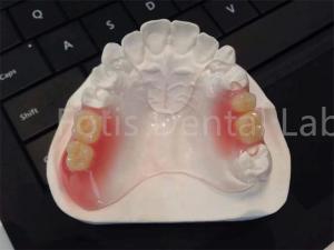 Quality Flexible TCS Valplast Dental Appliances Comfortable Durable Design wholesale