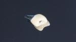 All On 4 Dental Tooth Implant Cylindrical Shape Titan Implant Dental Rough