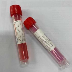 Quality Flocked Naopharyngeal Virus Collect Sampling Tube Medical Disposable wholesale