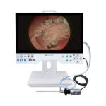 Hot Selling 15.6 Inch Full HD Integrated Endoscopic Camera & Display System for