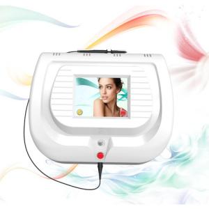High Frequency 30MHZ spider vein removal