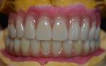 Elevating Standards Our Dental Implant Crown Quality Assurance