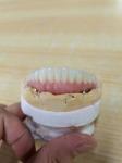 Elevating Standards Our Dental Implant Crown Quality Assurance