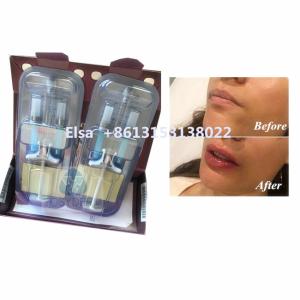 Quality Beauty product Juvederm Voluma Hyaluronic Acid Facial Filler HA Injection wholesale